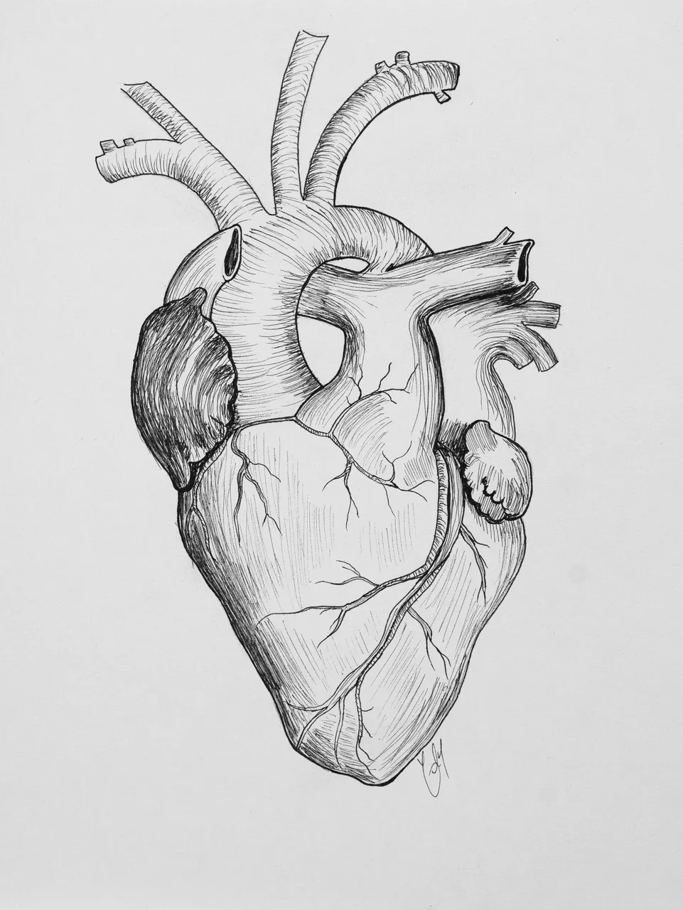 Vessel
